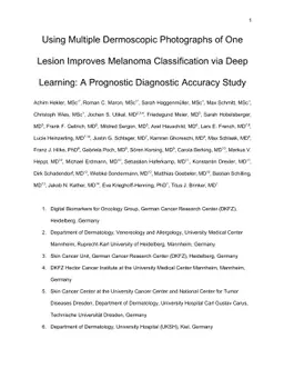 Using Multiple Dermoscopic Photographs of One Lesion Improves Melanoma
  Classification via Deep Learning: A Prognostic Diagnostic Accuracy Study