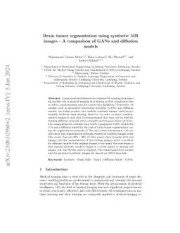 Brain tumor segmentation using synthetic MR images -- A comparison of
  GANs and diffusion models
