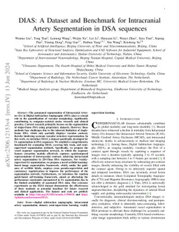 DIAS: A Dataset and Benchmark for Intracranial Artery Segmentation in
  DSA sequences