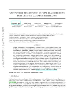 Unsupervised Segmentation of Fetal Brain MRI using Deep Learning
  Cascaded Registration