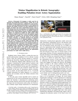 Motion Magnification in Robotic Sonography: Enabling Pulsation-Aware
  Artery Segmentation