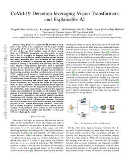 CoVid-19 Detection leveraging Vision Transformers and Explainable AI