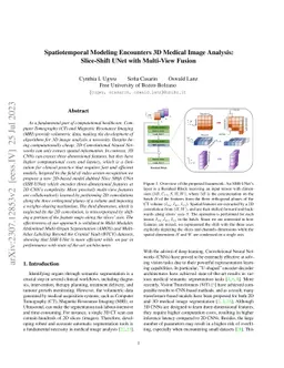 Spatiotemporal Modeling Encounters 3D Medical Image Analysis:
  Slice-Shift UNet with Multi-View Fusion