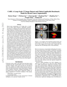 CARE: A Large Scale CT Image Dataset and Clinical Applicable Benchmark
  Model for Rectal Cancer Segmentation