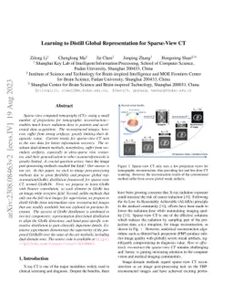 Learning to Distill Global Representation for Sparse-View CT