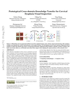 Prototypical Cross-domain Knowledge Transfer for Cervical Dysplasia
  Visual Inspection