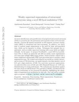Weakly supervised segmentation of intracranial aneurysms using a novel
  3D focal modulation UNet