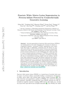 Punctate White Matter Lesion Segmentation in Preterm Infants Powered by
  Counterfactually Generative Learning