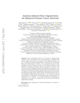 Anatomy-informed Data Augmentation for Enhanced Prostate Cancer
  Detection