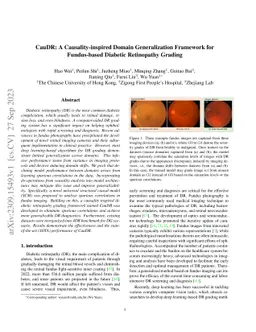 CauDR: A Causality-inspired Domain Generalization Framework for
  Fundus-based Diabetic Retinopathy Grading