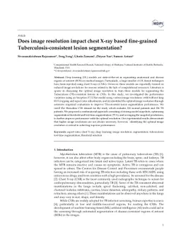 Does image resolution impact chest X-ray based fine-grained
  Tuberculosis-consistent lesion segmentation?