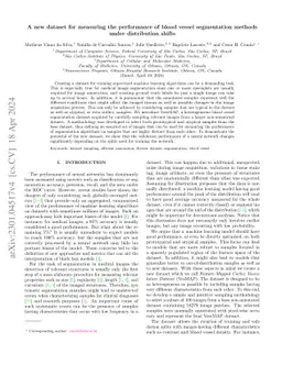 A new dataset for measuring the performance of blood vessel segmentation
  methods under distribution shifts