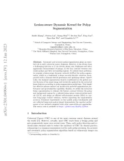 Lesion-aware Dynamic Kernel for Polyp Segmentation