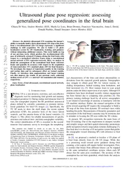 Ultrasound Plane Pose Regression: Assessing Generalized Pose Coordinates
  in the Fetal Brain