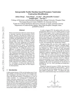 Interpretable Tsetlin Machine-based Premature Ventricular Contraction
  Identification