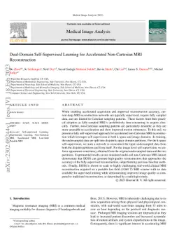 Dual-Domain Self-Supervised Learning for Accelerated Non-Cartesian MRI
  Reconstruction