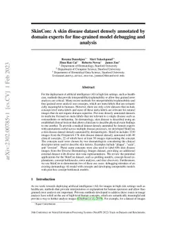 SkinCon: A skin disease dataset densely annotated by domain experts for
  fine-grained model debugging and analysis