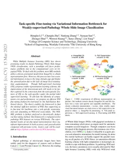 Task-specific Fine-tuning via Variational Information Bottleneck for
  Weakly-supervised Pathology Whole Slide Image Classification