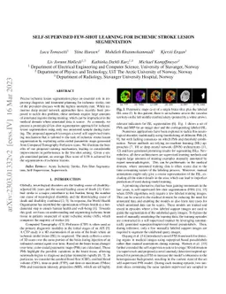 Self-Supervised Few-Shot Learning for Ischemic Stroke Lesion
  Segmentation
