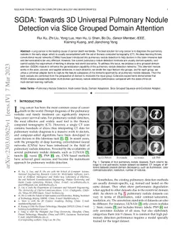 SGDA: Towards 3D Universal Pulmonary Nodule Detection via Slice Grouped
  Domain Attention