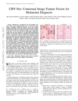 CIFF-Net: Contextual Image Feature Fusion for Melanoma Diagnosis