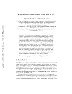 Causal Image Synthesis of Brain MR in 3D