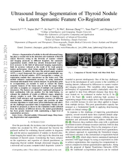 Ultrasound Image Segmentation of Thyroid Nodule via Latent Semantic
  Feature Co-Registration