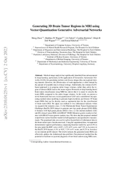 Generating 3D Brain Tumor Regions in MRI using Vector-Quantization
  Generative Adversarial Networks