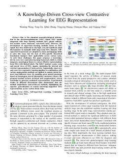 A Knowledge-Driven Cross-view Contrastive Learning for EEG
  Representation