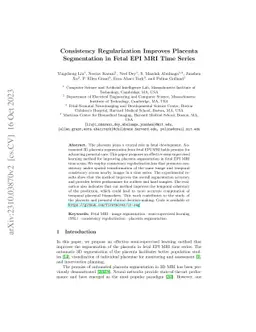 Consistency Regularization Improves Placenta Segmentation in Fetal EPI
  MRI Time Series