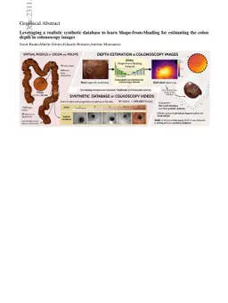 Leveraging a realistic synthetic database to learn Shape-from-Shading
  for estimating the colon depth in colonoscopy images