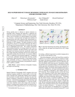 Self-supervised OCT Image Denoising with Slice-to-Slice Registration and
  Reconstruction