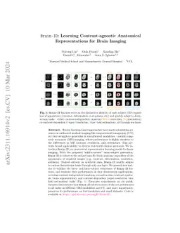 Brain-ID: Learning Contrast-agnostic Anatomical Representations for
  Brain Imaging