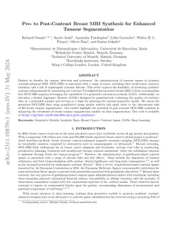 Pre- to Post-Contrast Breast MRI Synthesis for Enhanced Tumour
  Segmentation