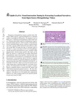 Quilt-LLaVA: Visual Instruction Tuning by Extracting Localized Narratives from Open-Source Histopathology Videos