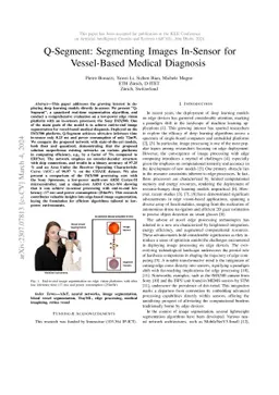 Q-Segment: Segmenting Images In-Sensor for Vessel-Based Medical
  Diagnosis