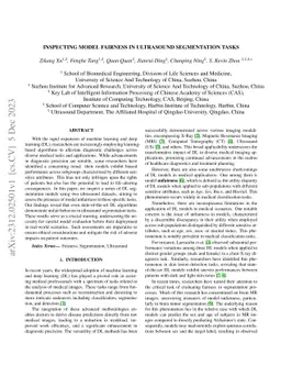 Inspecting Model Fairness in Ultrasound Segmentation Tasks