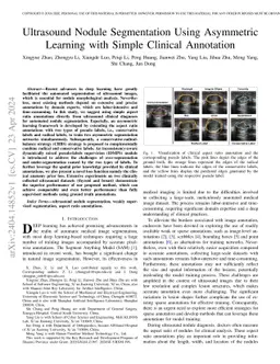 Ultrasound Nodule Segmentation Using Asymmetric Learning with Simple
  Clinical Annotation