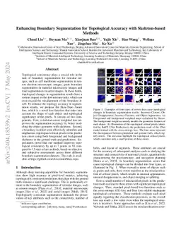 Enhancing Boundary Segmentation for Topological Accuracy with
  Skeleton-based Methods