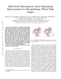 Multi-Scale Heterogeneity-Aware Hypergraph Representation for
  Histopathology Whole Slide Images