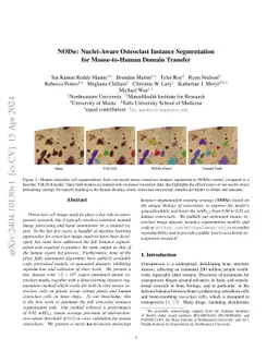 NOISe: Nuclei-Aware Osteoclast Instance Segmentation for Mouse-to-Human
  Domain Transfer