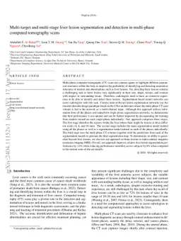 Multi-target and multi-stage liver lesion segmentation and detection in
  multi-phase computed tomography scans