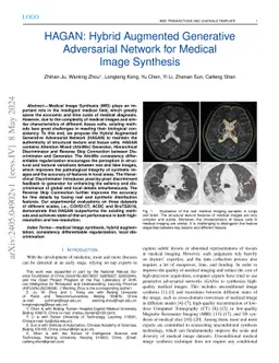 HAGAN: Hybrid Augmented Generative Adversarial Network for Medical Image
  Synthesis