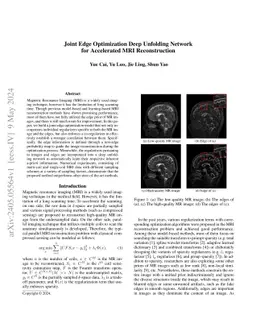 Joint Edge Optimization Deep Unfolding Network for Accelerated MRI
  Reconstruction