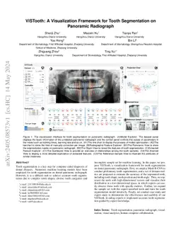 ViSTooth: A Visualization Framework for Tooth Segmentation on Panoramic
  Radiograph