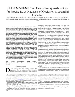 ECG-SMART-NET: A Deep Learning Architecture for Precise ECG Diagnosis of Occlusion Myocardial Infarction