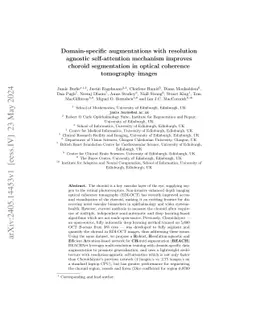 Domain-specific augmentations with resolution agnostic self-attention
  mechanism improves choroid segmentation in optical coherence tomography
  images