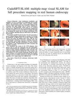 CudaSIFT-SLAM: multiple-map visual SLAM for full procedure mapping in
  real human endoscopy