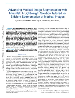 Advancing Medical Image Segmentation with Mini-Net: A Lightweight
  Solution Tailored for Efficient Segmentation of Medical Images