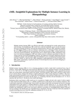 xMIL: Insightful Explanations for Multiple Instance Learning in Histopathology